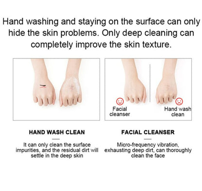 only deep cleaning can completely improve the skin texture . only hand washing