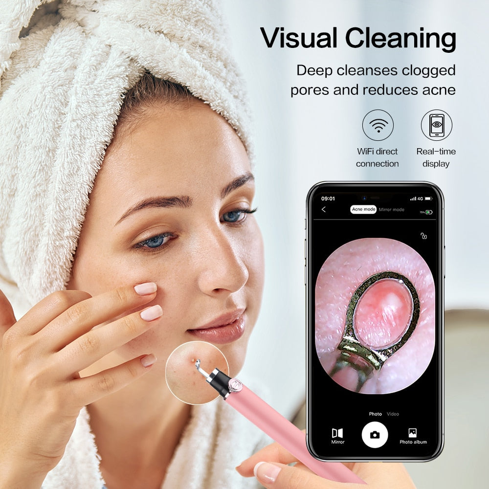 Smart Visual Blackhead Remover Acne Needle Cleansing Cosmetic Devices Acne Squeeze Pore Cleaner Facial Treatment With Camera