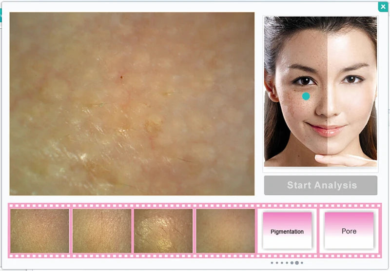 Scan skin for pigmentation and pore analysis