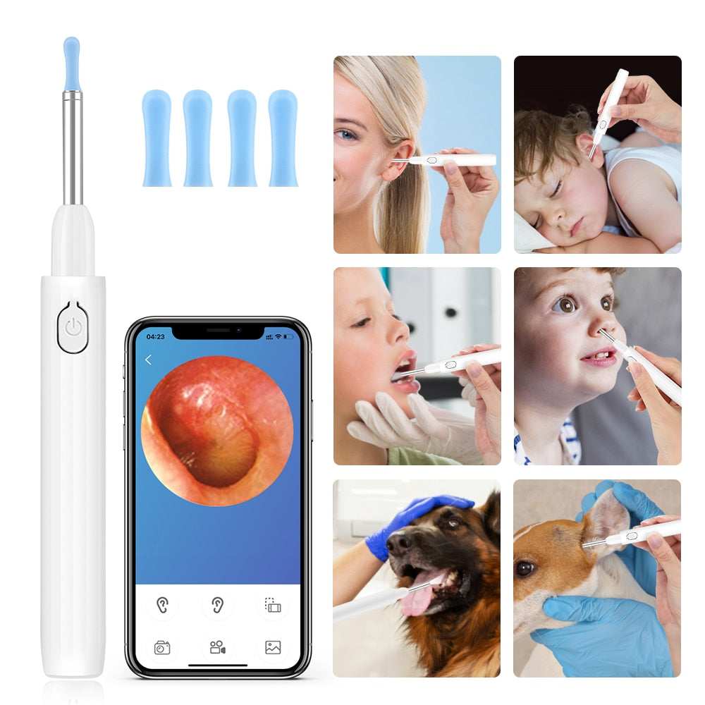 Wireless Smart Visual Ear Pick Removal Ear Wax Cleaner Spoon 3.5mm Endoscope HD Camera Otoscope LED Light Earwax Cleaning Kit