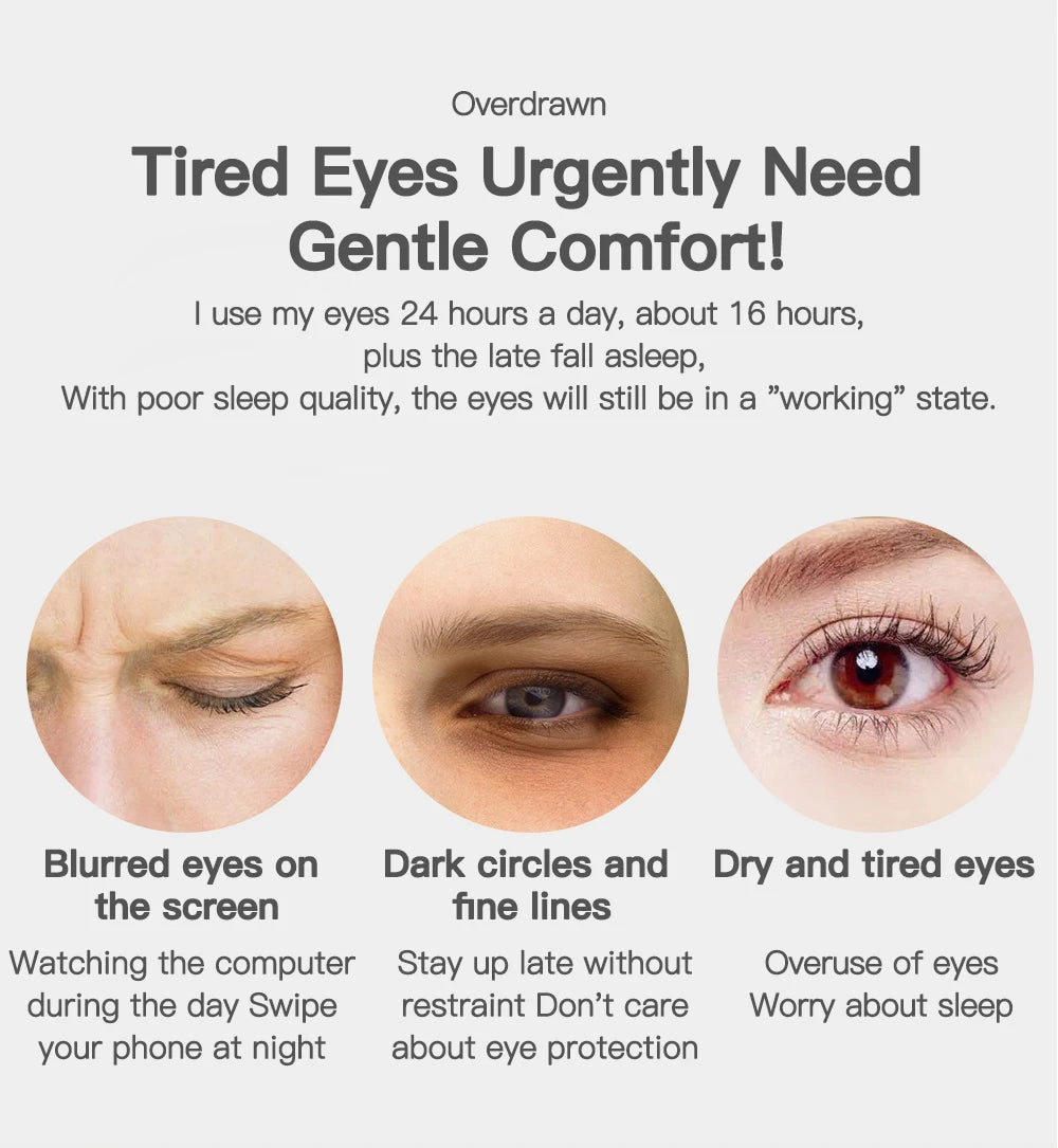 Eye care alert: constant screen use, poor sleep, and fatigue lead to dark circles, blurred vision, and strain.