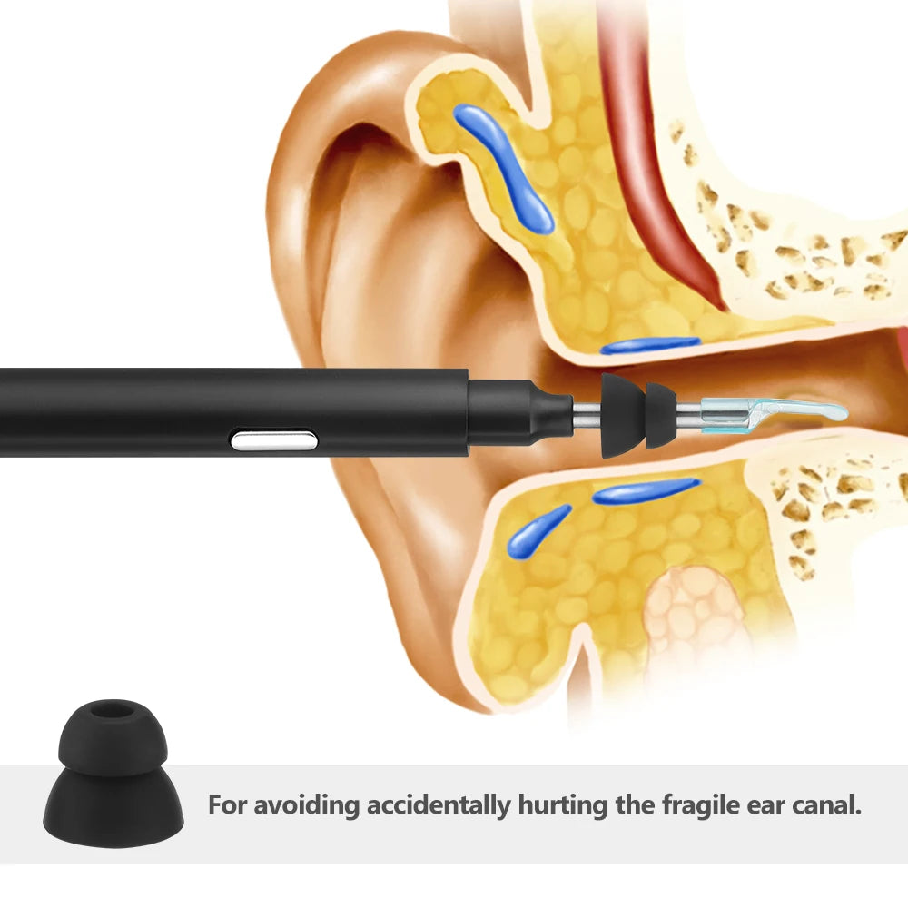 Wireless ear pick otoscope camera for oral inspection and health care, featuring a luminous design.