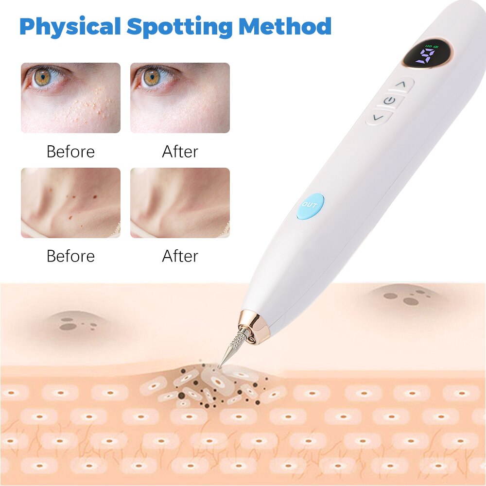 Mole Spot Scanning Scar Mole Wart Age Freckle Blackhead Removal Pen Needle Light LED Screen 9 Speed Tattoo Plasma Dark