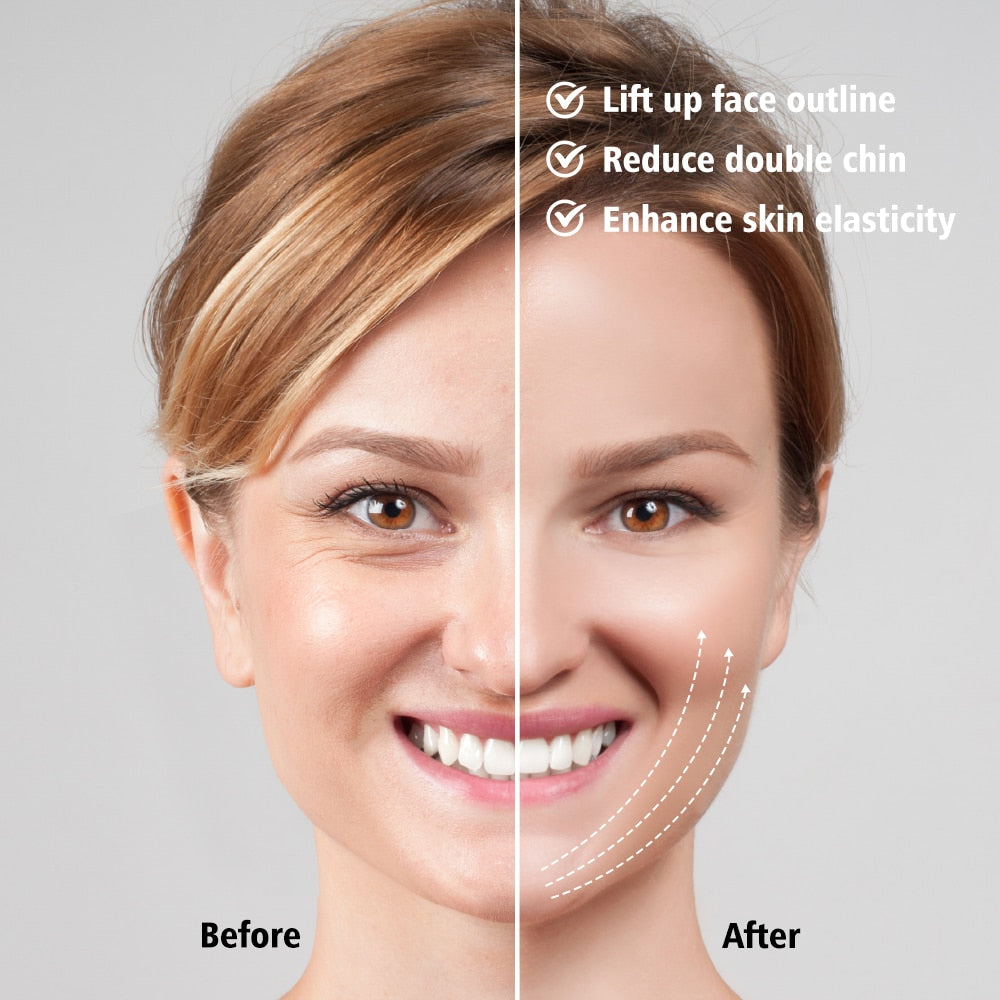 Lift up face outline Reduce double chin Enhance skin elasticity Before