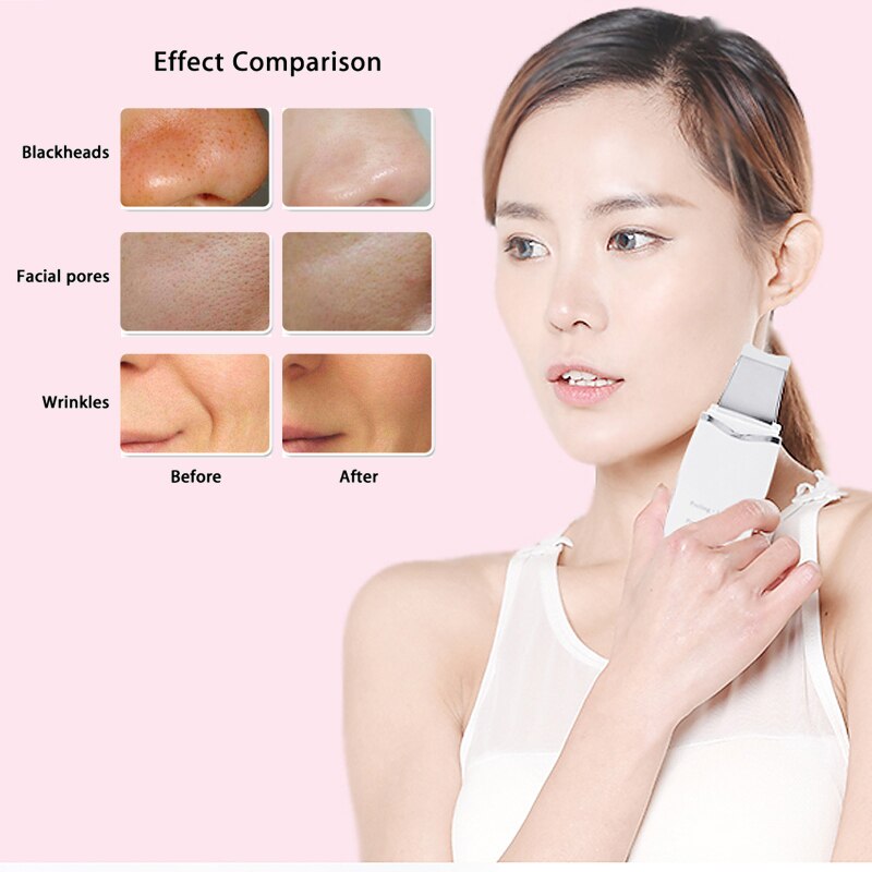 HSKOU Ultrasonic Skin Scrubber Deep Face Cleaning Machine Peeling Shovel Facial Pore Cleaner Face Skin Scrubber Lift Machine