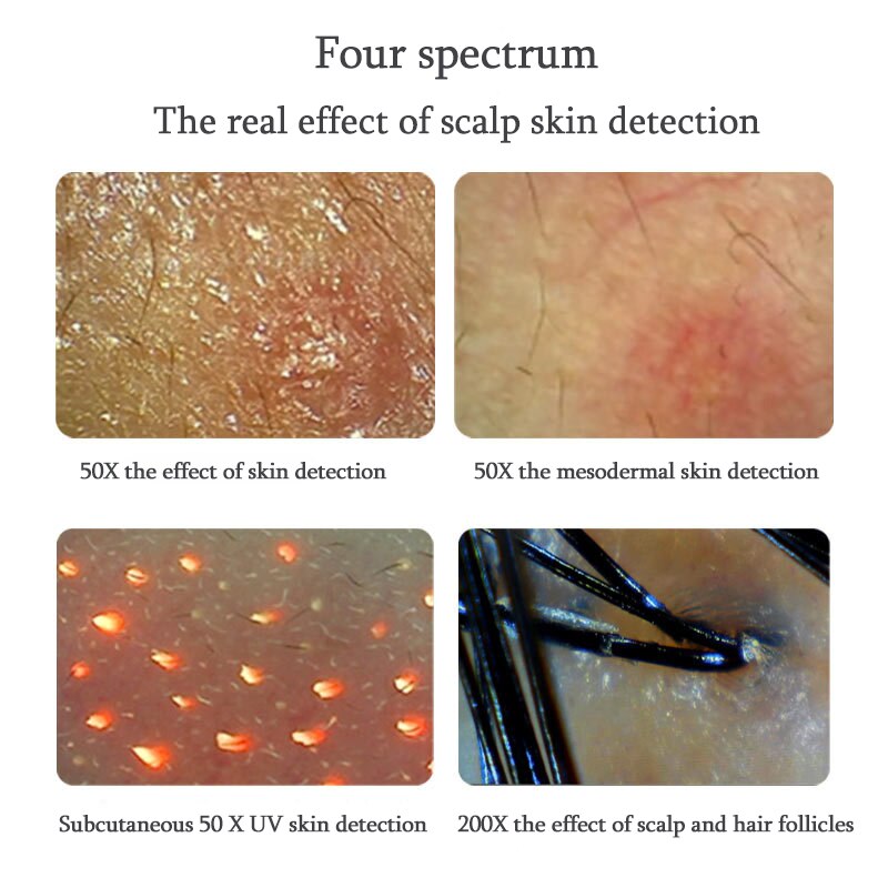 Máquina de analisador de pele UV profissional, detector de couro cabeludo, folículos capilares, óleo, umidade, testador, máquina de analisador de cabelo de pele facial 11 polegadas