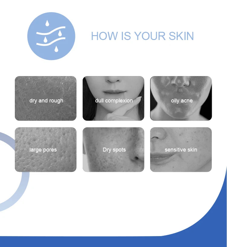 Various skin types, including dry, rough, dull, oily, acne-prone, and large-pored skin, with accompanying sensitivity issues.