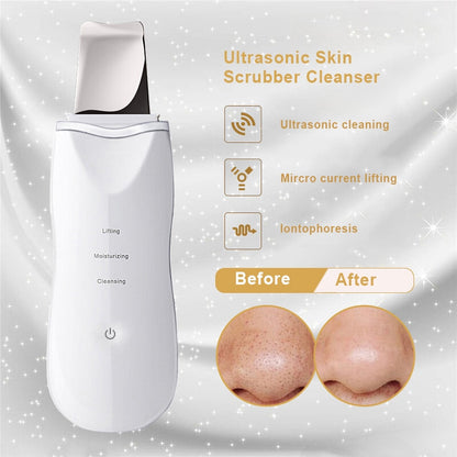 HSKOU Ultrasonic Skin Scrubber Deep Face Cleaning Machine Peeling Shovel Facial Pore Cleaner Face Skin Scrubber Lift Machine