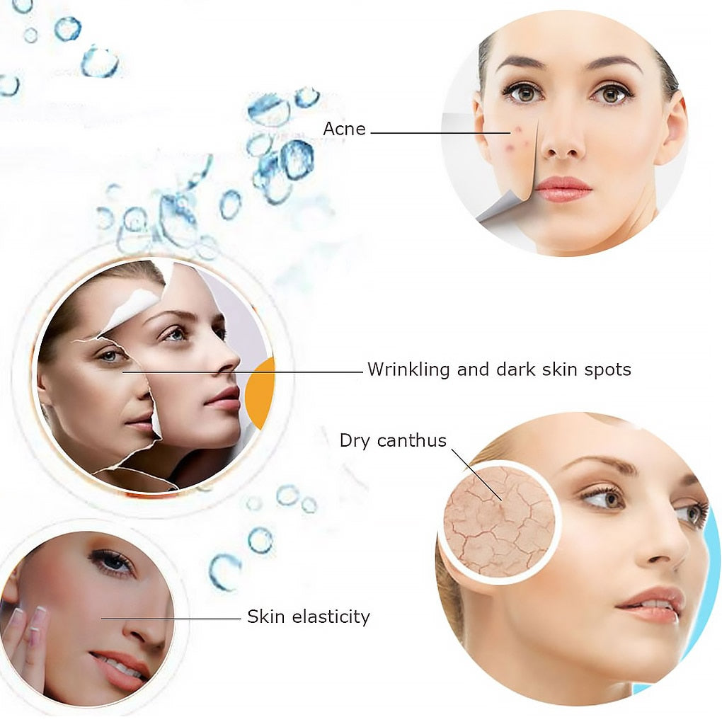 Acne Wrinkling and dark skin spots Dry canthus