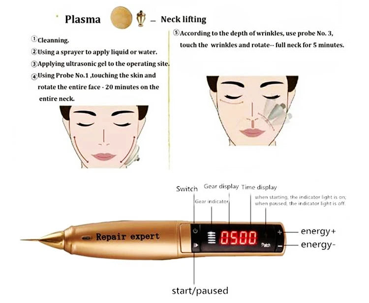 Ozone Plasma Pen: removes freckles, moles, facial imperfections, neck tightens and acne scars.