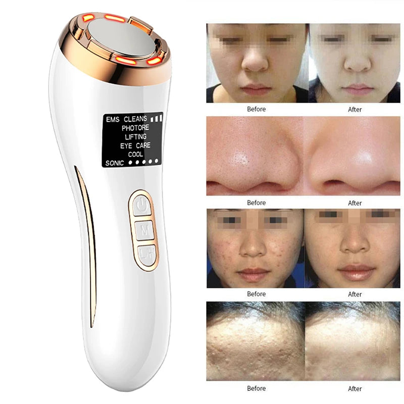 Revitalizing facial massager combines EMS, LED, RF, and sonic tech for tighter, more youthful-looking skin.