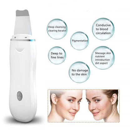 Depurador de piel ultrasónico Limpiador de poros Peeling facial Limpieza facial profunda Peeling sónico EMS Radiofrecuencia Masajeador facial