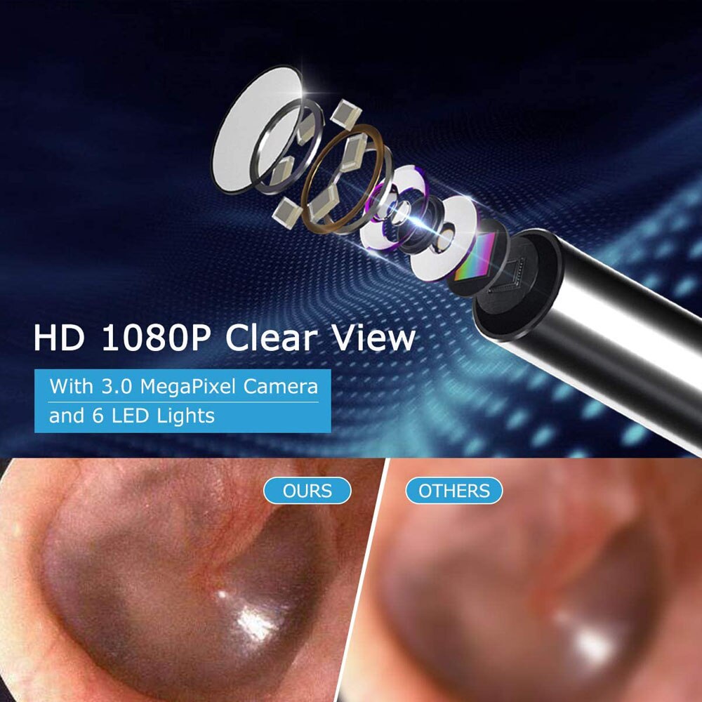 HD 1080P Clear View With 3.0 MegaPixel