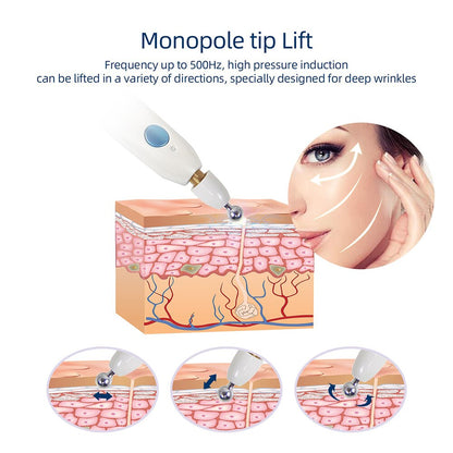 Monopole tip Lift Frequency up to SOOHz, high