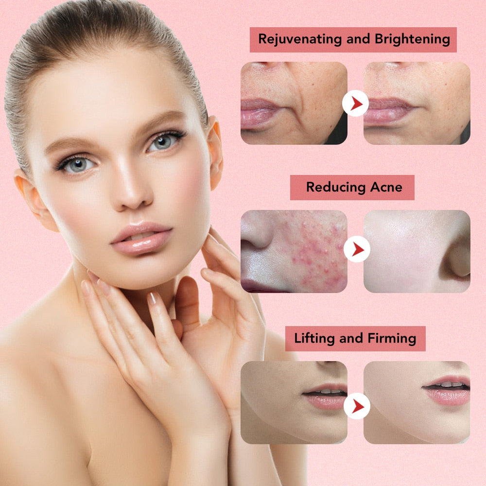 Rejuvenating and Brightening Reducing Acne