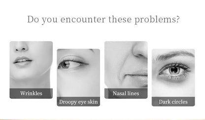 Do you encounter these problems? Wrinkles Nasal lines Droop