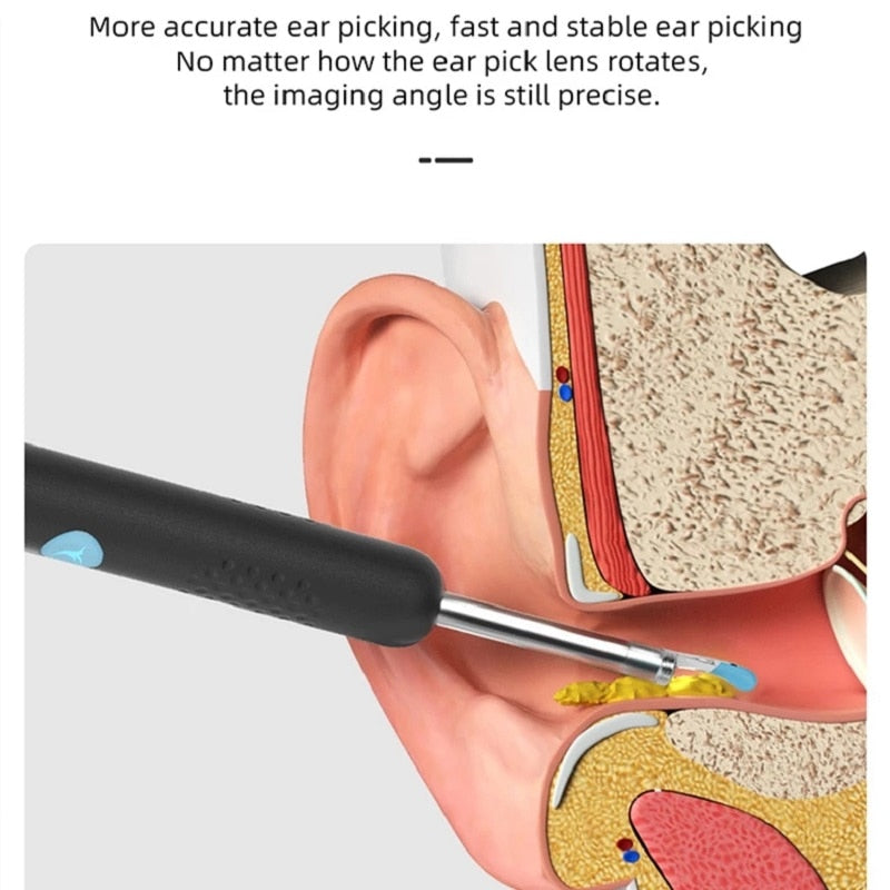 the ear pick lens rotates, but the imaging angle is still