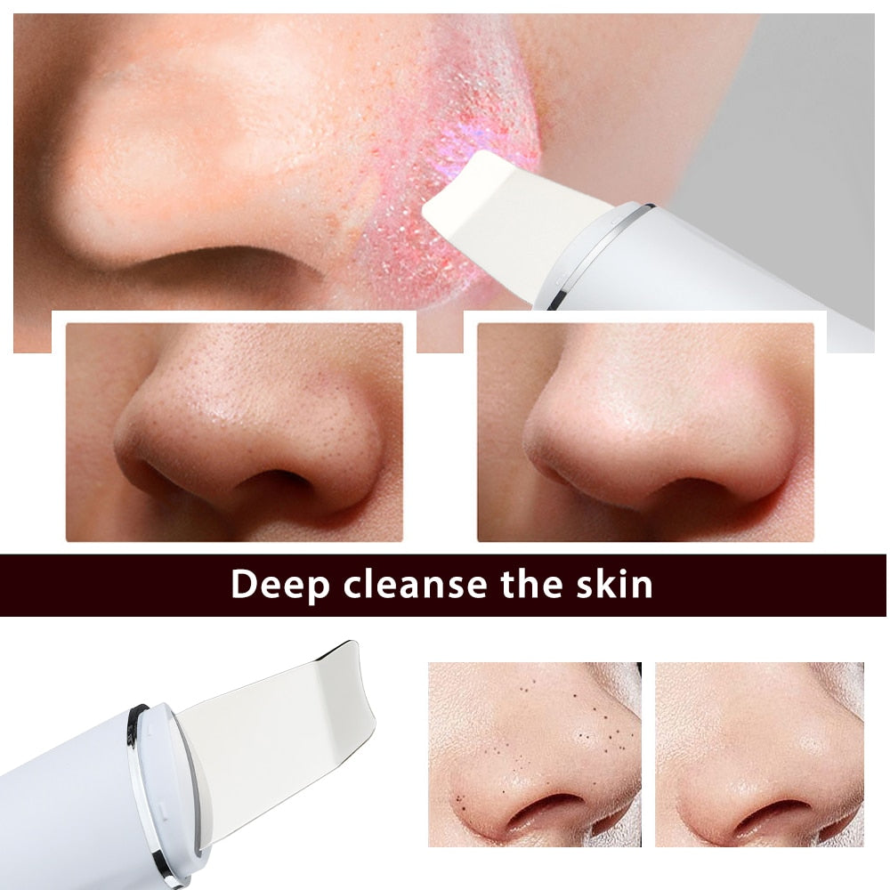 Ultrasonic Skin Scrubber Peeling Shovel EMS Microcorrente Íon Acne Removedor de Cravos Facial Limpeza Profunda Dispositivos de Levantamento Facial