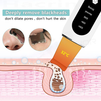 Ultrasonic Skin Scrubber Remove Blackhead Cleaning Deep Face Cleaner Ultrasonic Shovel Facial Peeling Cleaning Acne 26000hz