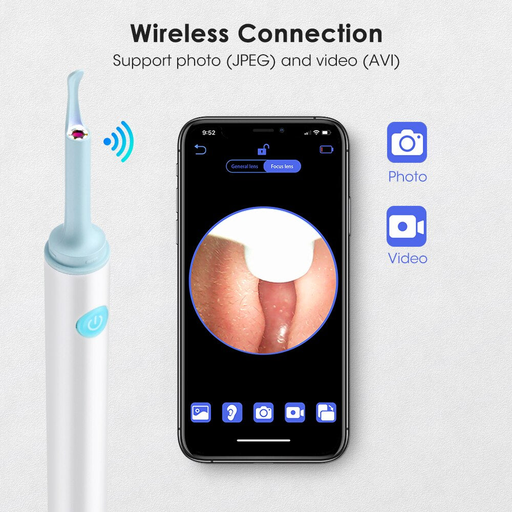 Limpiador Visual inteligente inalámbrico para oídos, otoscopio, WiFi, palillo luminoso para los oídos, herramienta de eliminación de cera para los oídos con cámara, endoscopio para oídos, removedor de cera para los oídos