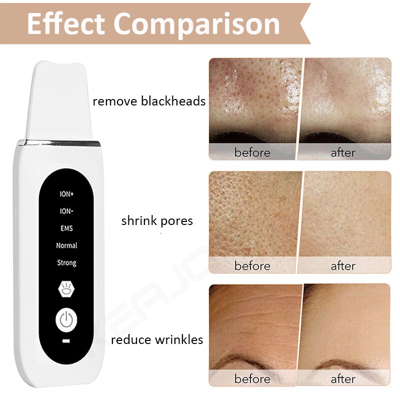 Ultrasonic Skin Scrubber Remove Blackhead Cleaning Deep Face Cleaner Ultrasonic Shovel Facial Peeling Cleaning Acne 26000hz