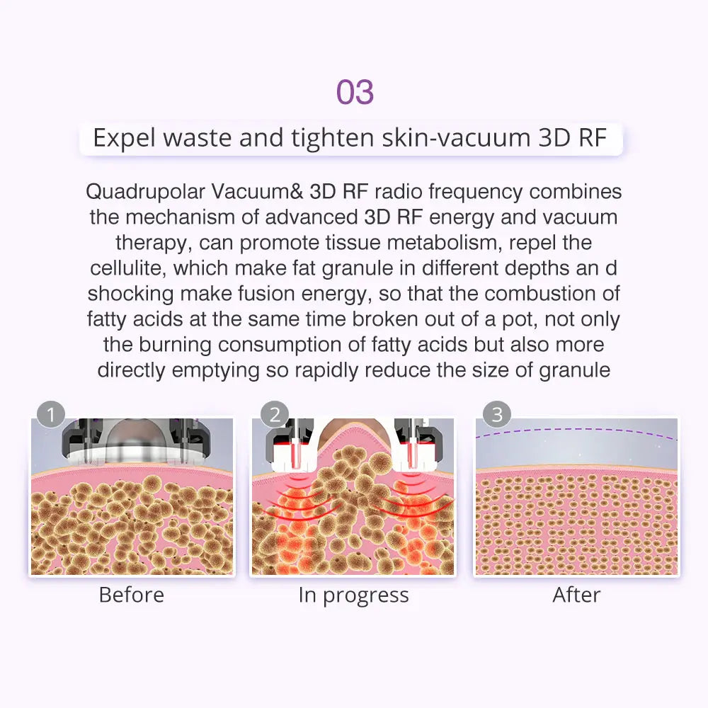 RF quadrupolar vacuum technology expels waste and tightens skin for rapid fat reduction and improved body and facial care.