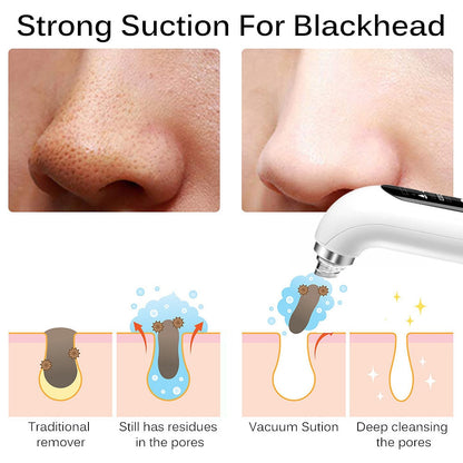 Strong Suction For Blackhead Traditional Still has residues Vacuum