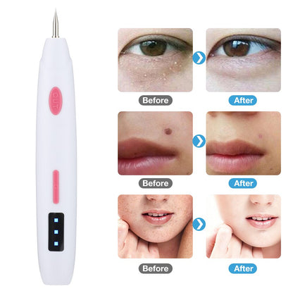 Skin Tag Remover Wart Berrugas Eliminator Plasma Pen Freckle Remove Electric Beauty Spot Pen Remove Mole Spots Warts Tattoos