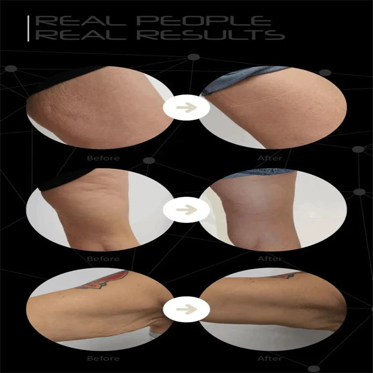 Multi-functional device for weight loss, skin tightening, and fat burning.