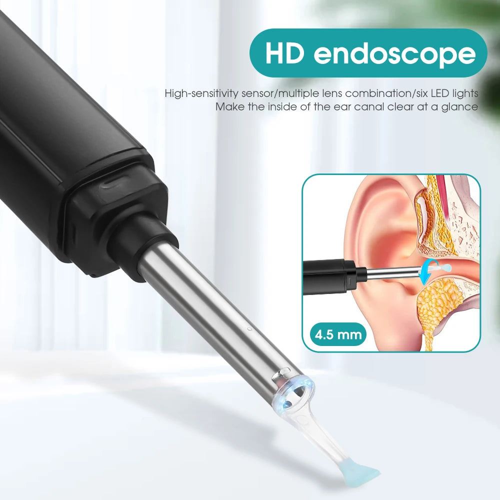 HD endoscope with sensors and lenses, plus LED lights, provides clear view of ear canal for inspection.