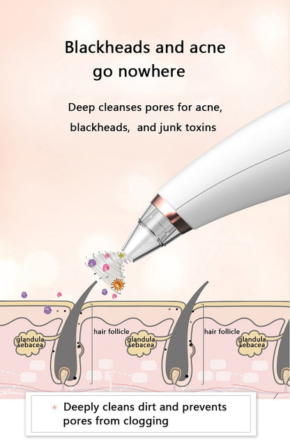 deep cleanses pores for acne, blackheads, and junk 