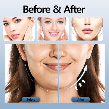 Chin-Up V Face Massager for Face EMS Facial Lifter Beauty Device Double Chin Remover Electric V-Line Up Facelift Shaper Belt