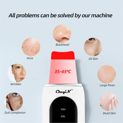 All problems can be solved by our machine Blackhead Ance Oil Skin