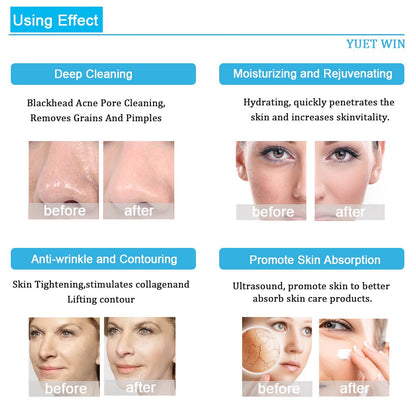 Using Effect YUET WIN Deep Cleaning, Hydrating