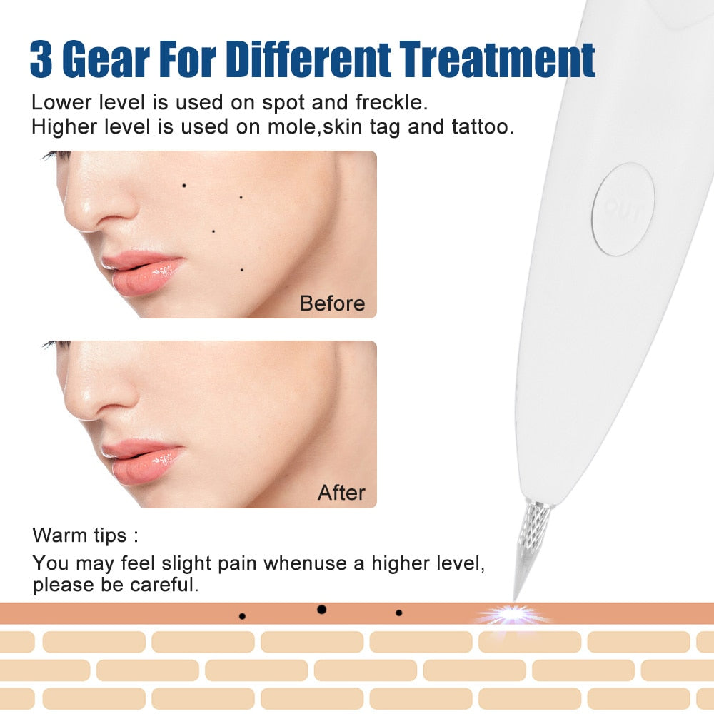 Plasma Stift Gesicht Haut Tag Entferner Warze Schwarze Flecken Sommersprossen Papillome Entferner Elektrische Plasma Jet Stift Hautpflege Schönheit Geräte