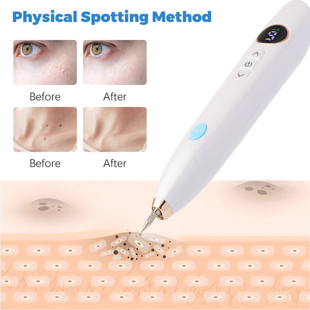 Physical Spotting Method L Before After Before After 99