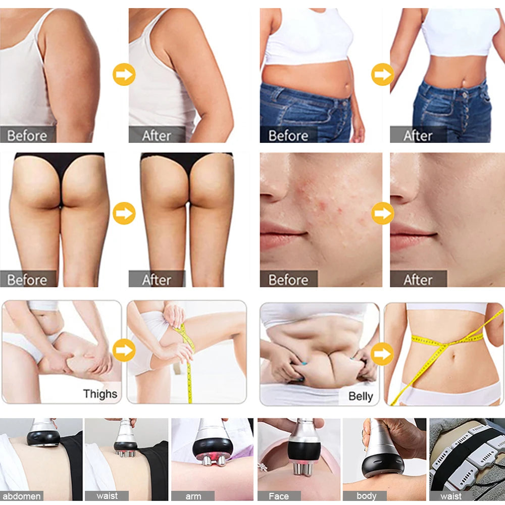 Before-and-after photos show visible results on various body parts after using this slimming machine.