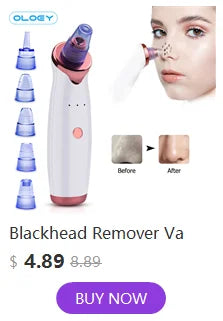 Relax and rejuvenate with our eye massager to reduce wrinkles, dark circles, and fatigue.