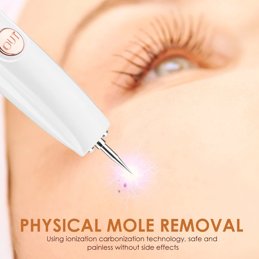 Safe mole removal through ionized carbonization tech with no side effects.