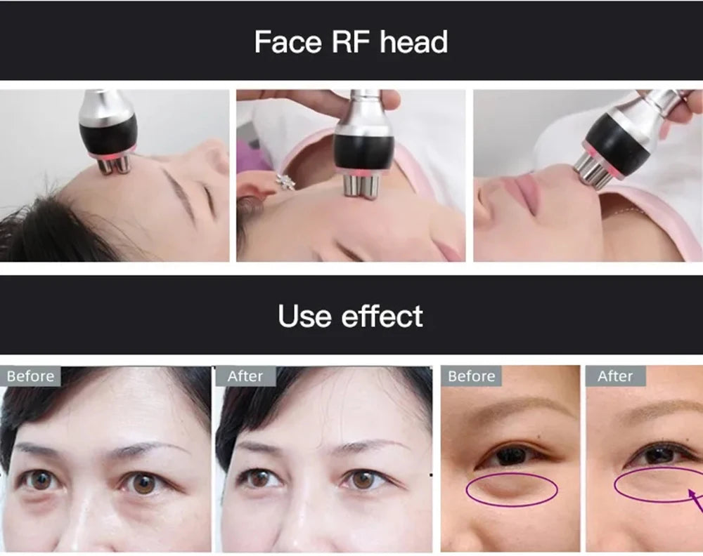 Enhance facial tone with RF technology for visible results before and after use.