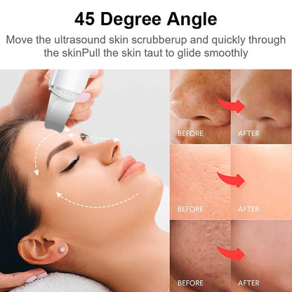 Ultrasonic Skin Scrubber Vibration Face Espátula Removedora de cravos Pá Limpeza Cavitação Peeling Facial Lifting Cuidados com a pele