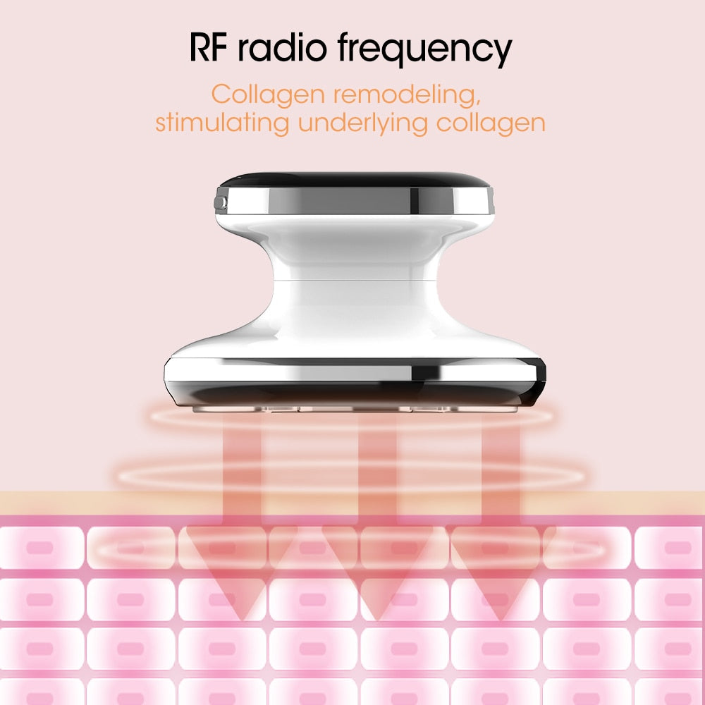 RF radio frequency Collagen remodeling; stimulating underlying