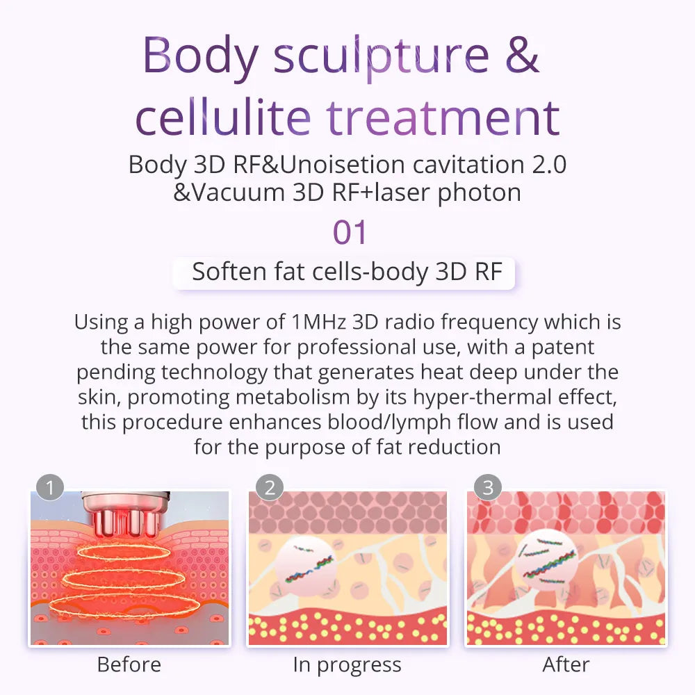 Body contouring device with RF, ultrasound, vacuum, and laser technologies for cellulite treatment and fat reduction.