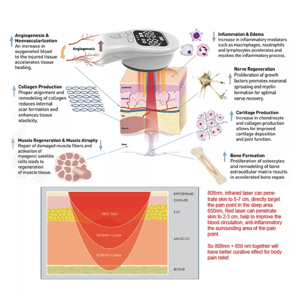 Laser therapy device for knee, arm, and elbow pain relief, promoting physical therapy and physiotherapy.