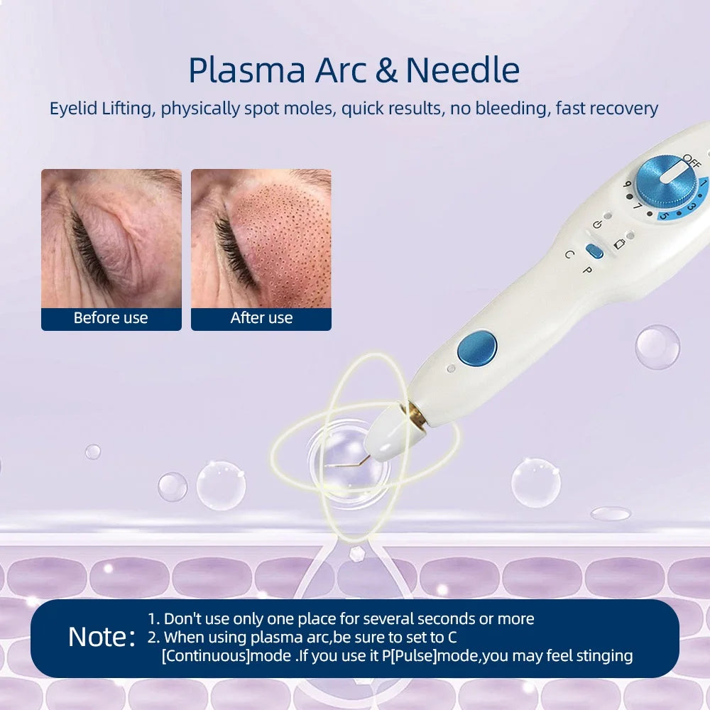 Eliminate wrinkles and moles with quick, non-invasive plasma pen treatments.