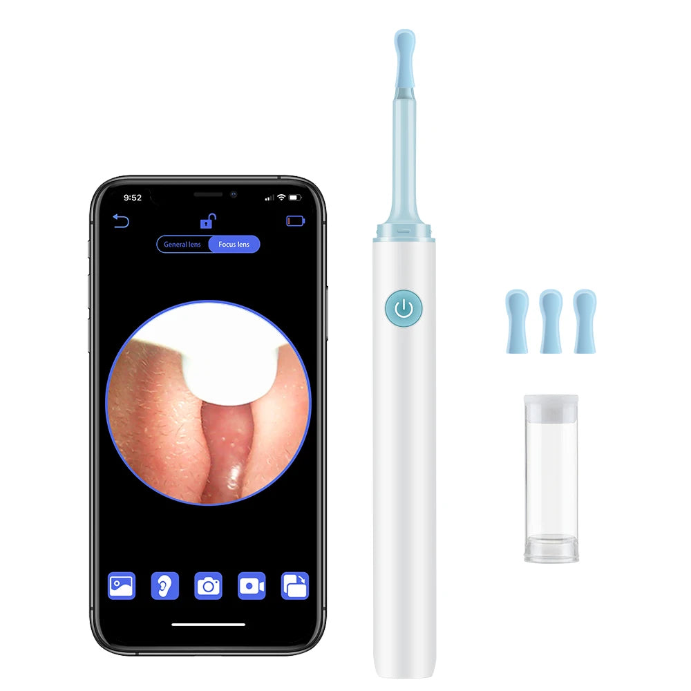 Ear picking tool with wireless visual endoscope and silicone tip for safe ear cleaning.