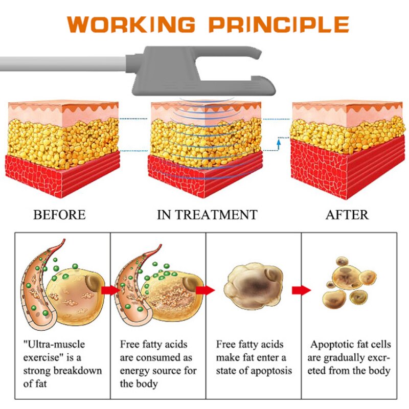 WORKING PRINCIPLE BEFORE IN TREATMENT