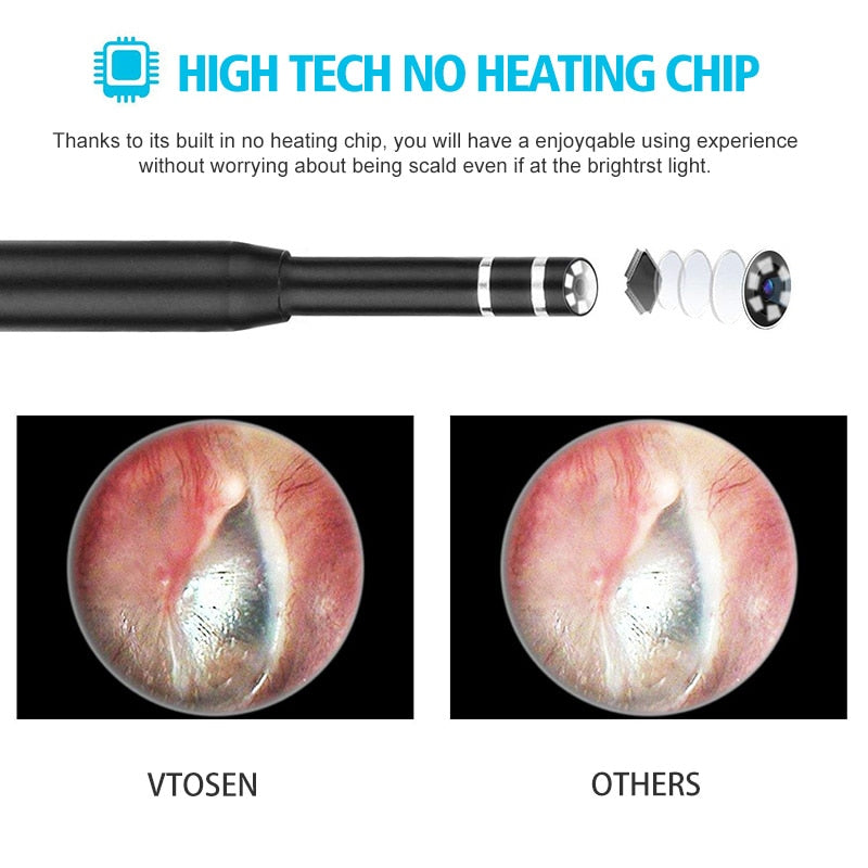 Smart HD Visual Ear Wax Cleaning Ear Cleaner Ear Stick Endoscópio Earpick Otoscópio digital Ferramenta de remoção de cera de ouvido com câmera