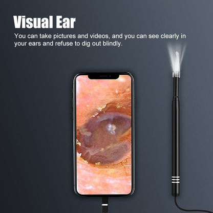 Smart Visual Ear Cleaner Ear Stick Endoscópio Earpick Camera Otoscópio Ear Cleaner Ear Wax Remover Ear Picker Ferramenta de remoção de cera