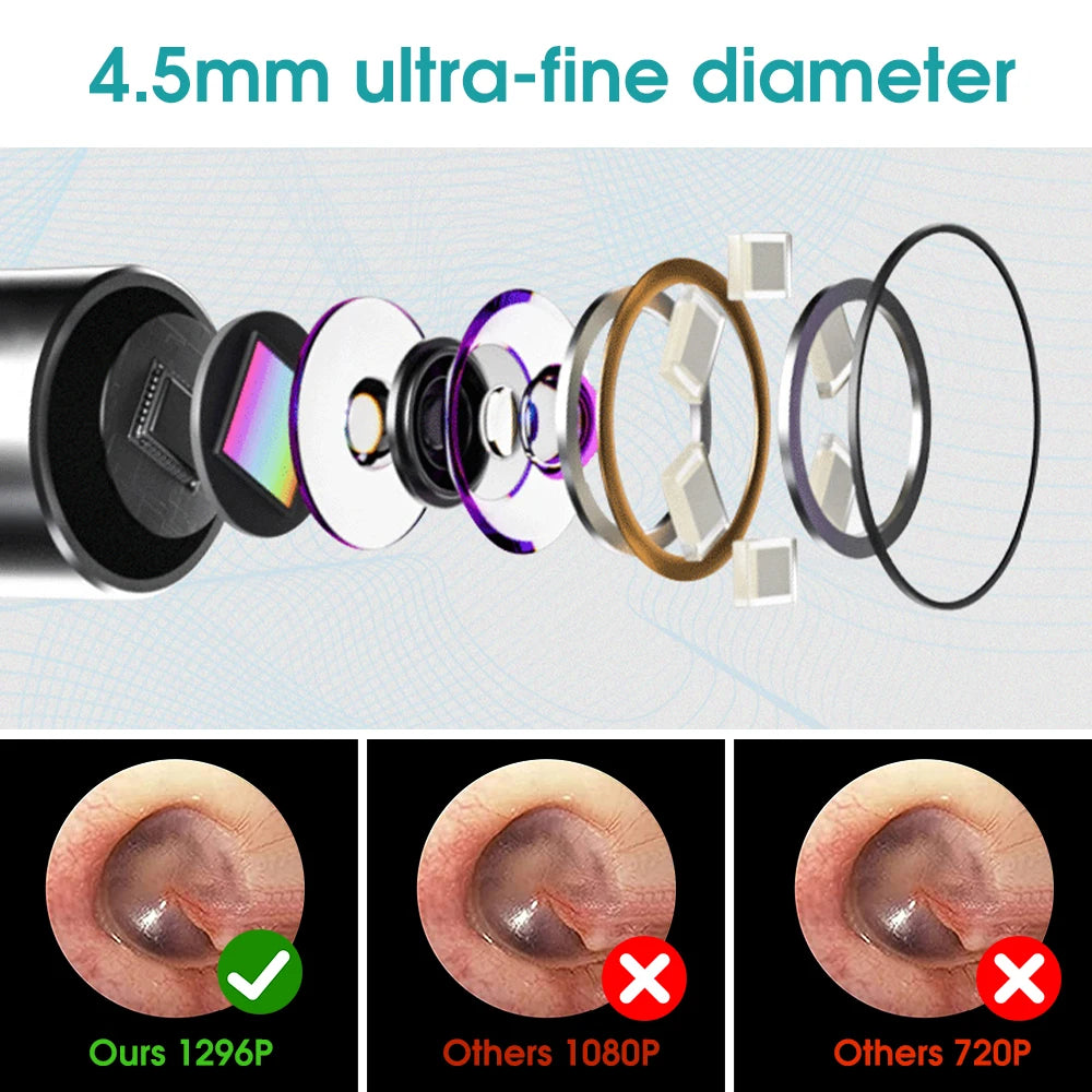 High-definition video and fine diameter for detailed oral examination and earwax removal.